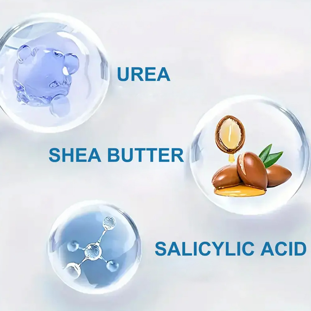 YOUNGCOME 250G Urea Cream with - огляд і ціна Urea Foot Cream