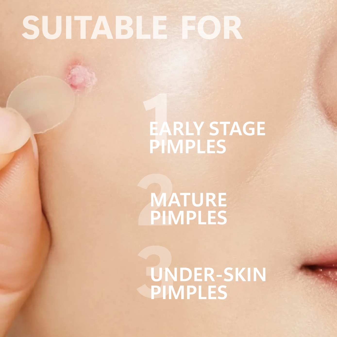 Micro Needle Pimple Patch (24  - огляд і ціна Face Moisturizer