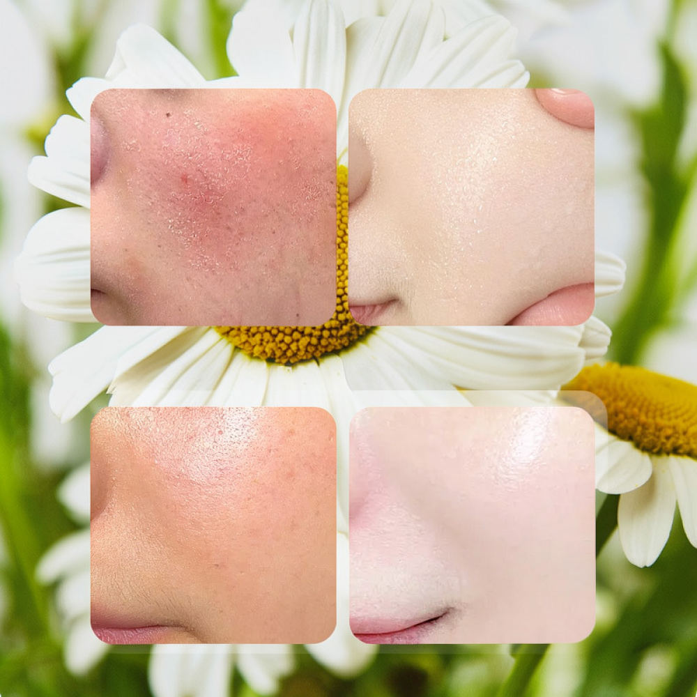 For Fykly Rose VC Chamomile B5 - огляд і ціна Face Mask Skincare
